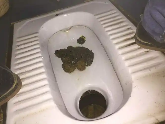 女生拉肚子拉稀,女生拉肚子穿裙子-图片大观-奇异网