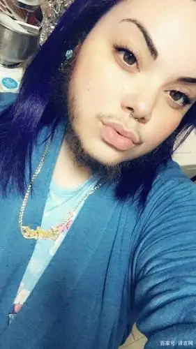 美国27岁女子满脸长出胡须却不刮掉,称顺其自然,蓄须是最好选择