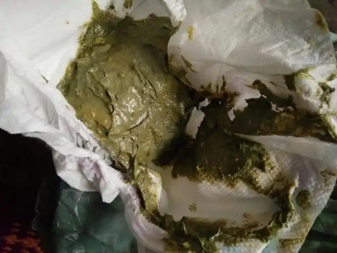 宝宝3个月三天拉这样臭臭正常吗?