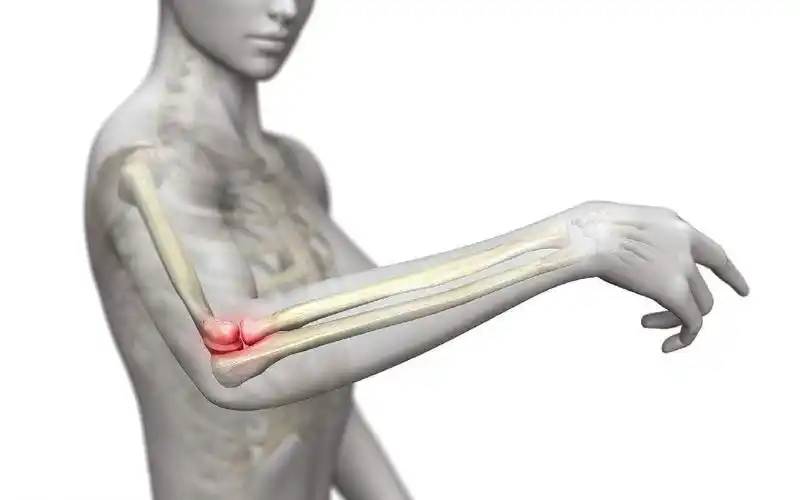 肱骨外上髁炎的诊疗思路,网球肘治疗思路讲解,正骨教学_哔哩哔哩_bili