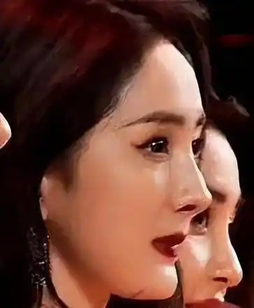 乍一看,这不是丑,因为许多美女明星都有类似的问题.