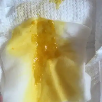 85天婴儿拉的都是水和黏液,是怎麼回事?_宝宝树