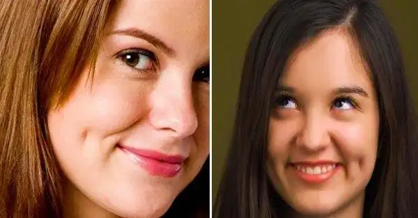 乳房两三事儿#酒窝征是乳腺癌的指征吗?(no:1937)