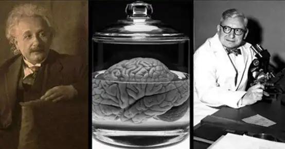 爱因斯坦的大脑被切成240片,结果什么都没研究出来 — 世界之最