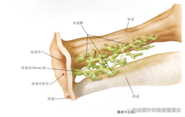 女性尿道外口鼓包包,到底是什么回事?