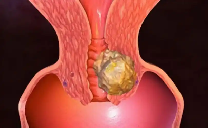 宫颈不好,经期将有4个提醒,若你一个没有,恭喜你宫颈健康