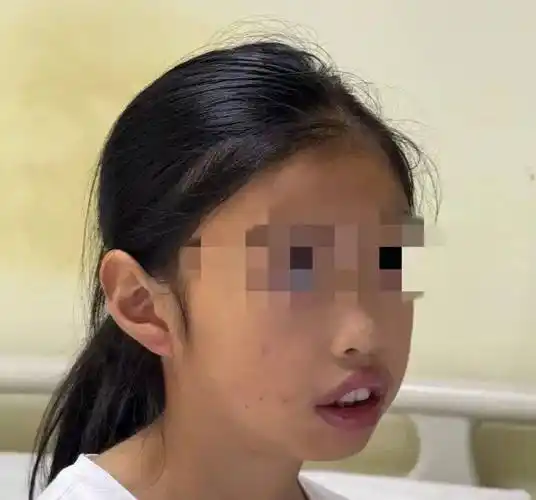 儿童腺样体肥大"嘎一刀"or"刀下留人"?听听儿童专家怎么说!