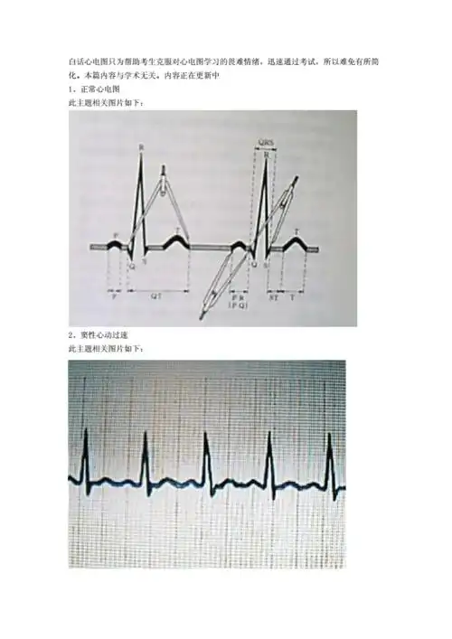 巧记心电图创新doc23页