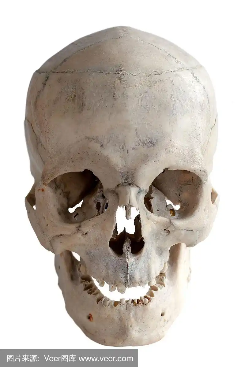 人头骨,充满的,白色,分离着色,人的脸部