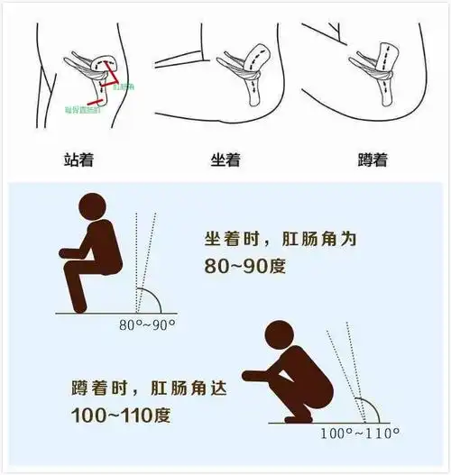坐位pk蹲位,您选对排便姿势了吗?
