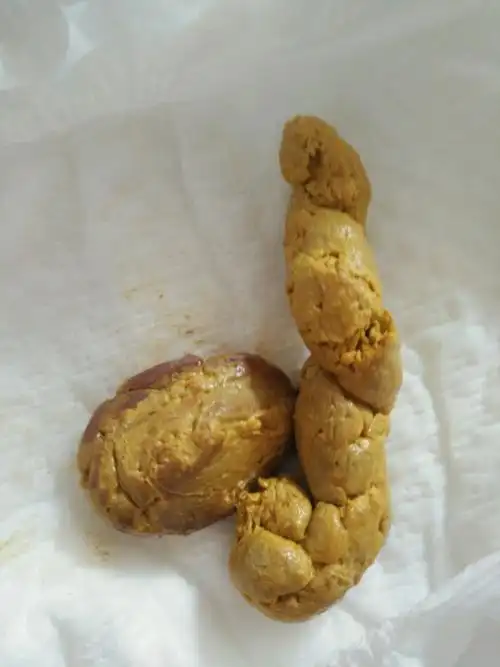 宝宝消化不好!有大便图,介意勿点!