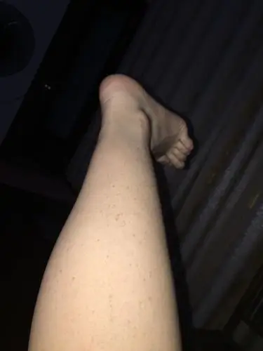 小腿肚这个是长什么?