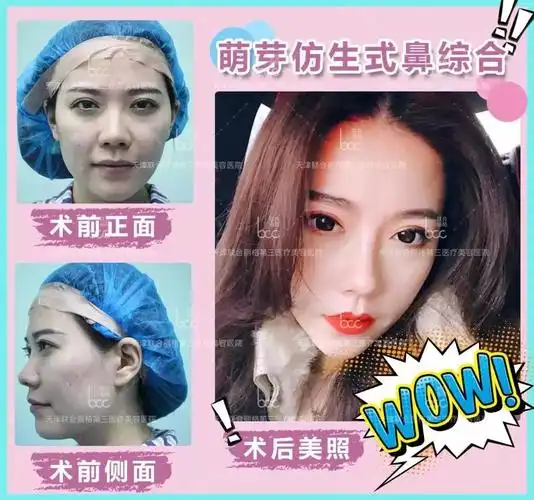 直播预告刘容嘉主任将在一直播开讲带你了解萌芽仿生鼻到底有多萌