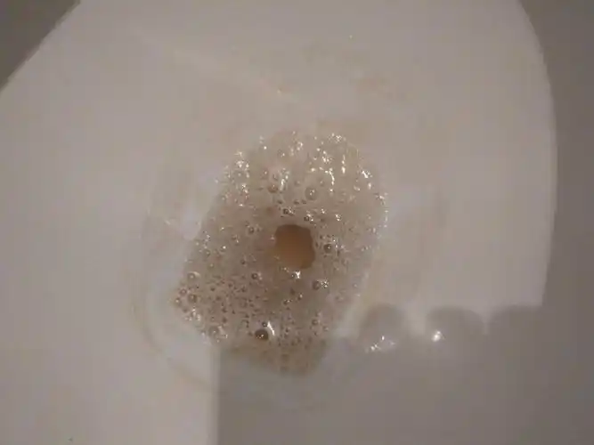 尿尿很多白色泡沫怎么回事