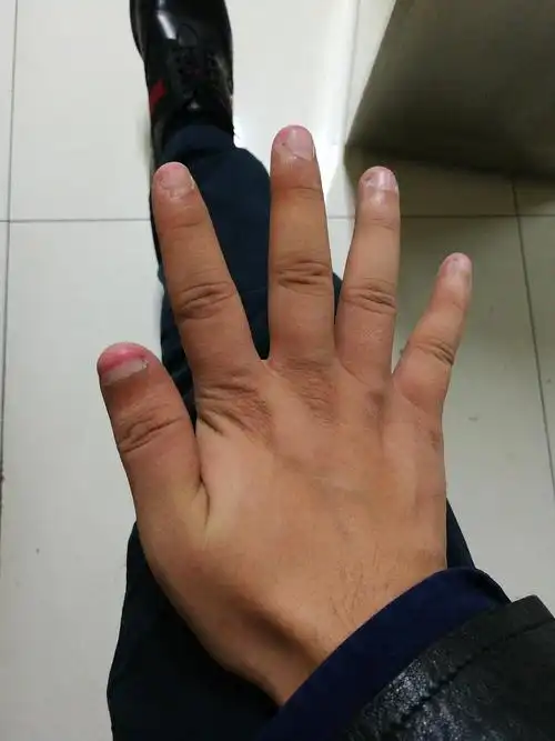 有没有喜欢把指甲剪的很短很短的