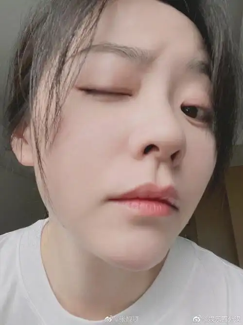 张靓颖素颜怼脸自拍照