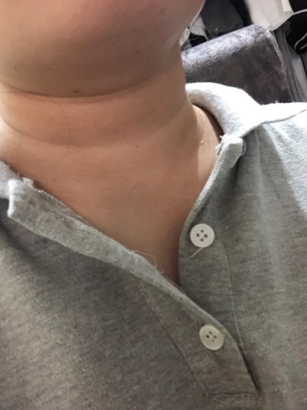 ———————— 颈部肌肤十分细